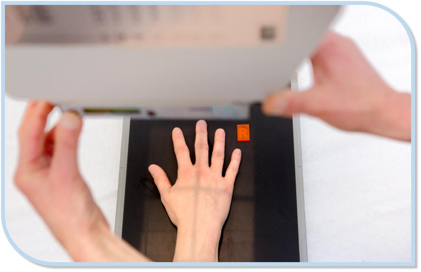 Zwei Hände positionieren eine Hand für eine Röntgenaufnahme, wobei die Handfläche flach auf einer dunklen Oberfläche liegt und ein orangefarbener Marker sichtbar ist.