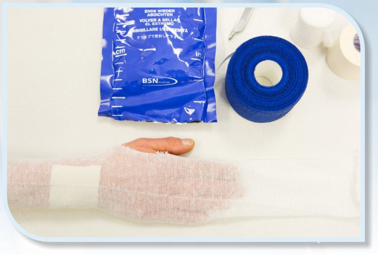 Nahaufnahme einer mit weißer Gaze verbundenen Hand auf einer sterilen Unterlage. Daneben liegen eine blaue Rolle Verbandsmaterial und eine blaue Verpackung.